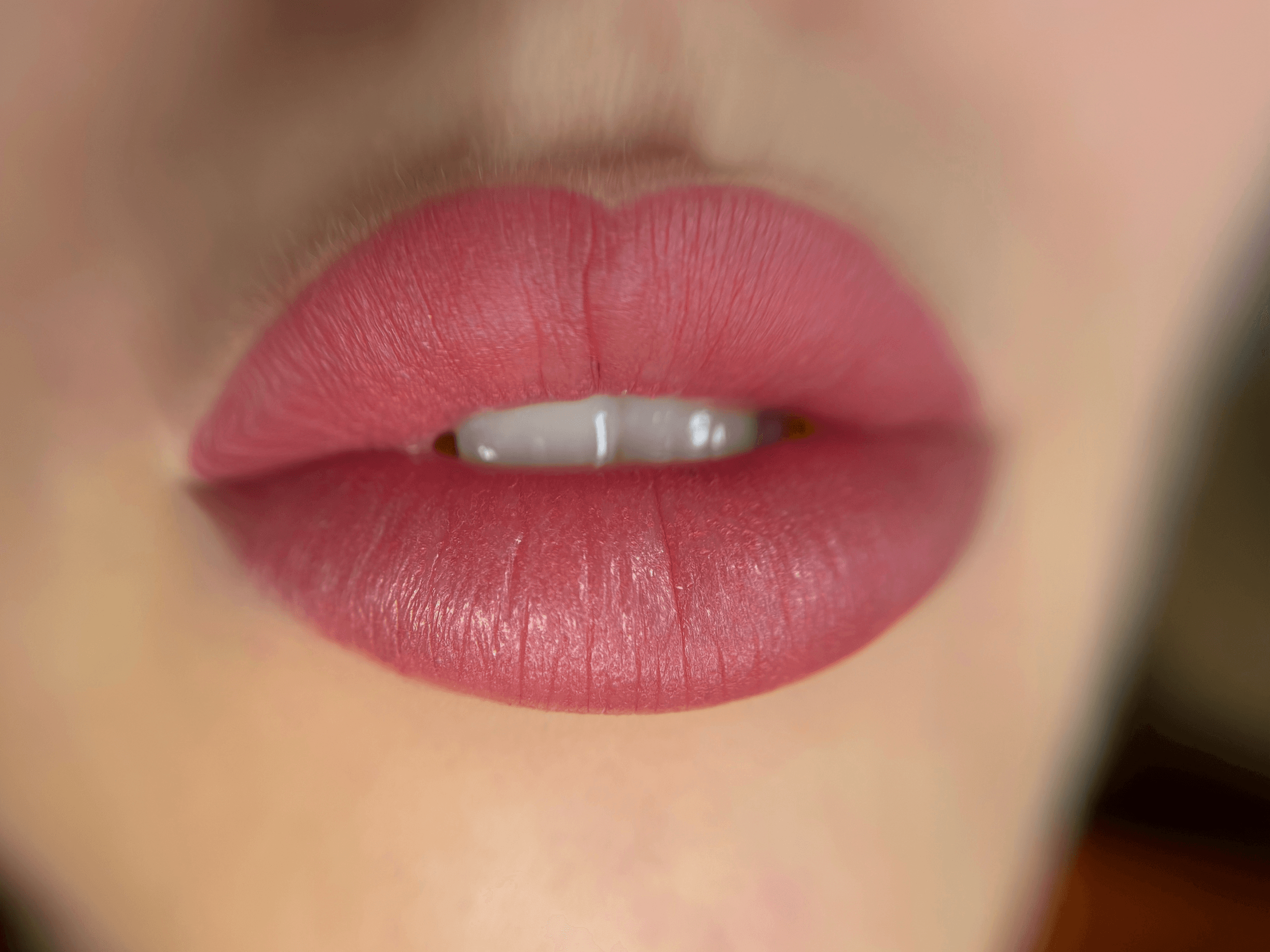 Pigmentace rtů ukázka 1